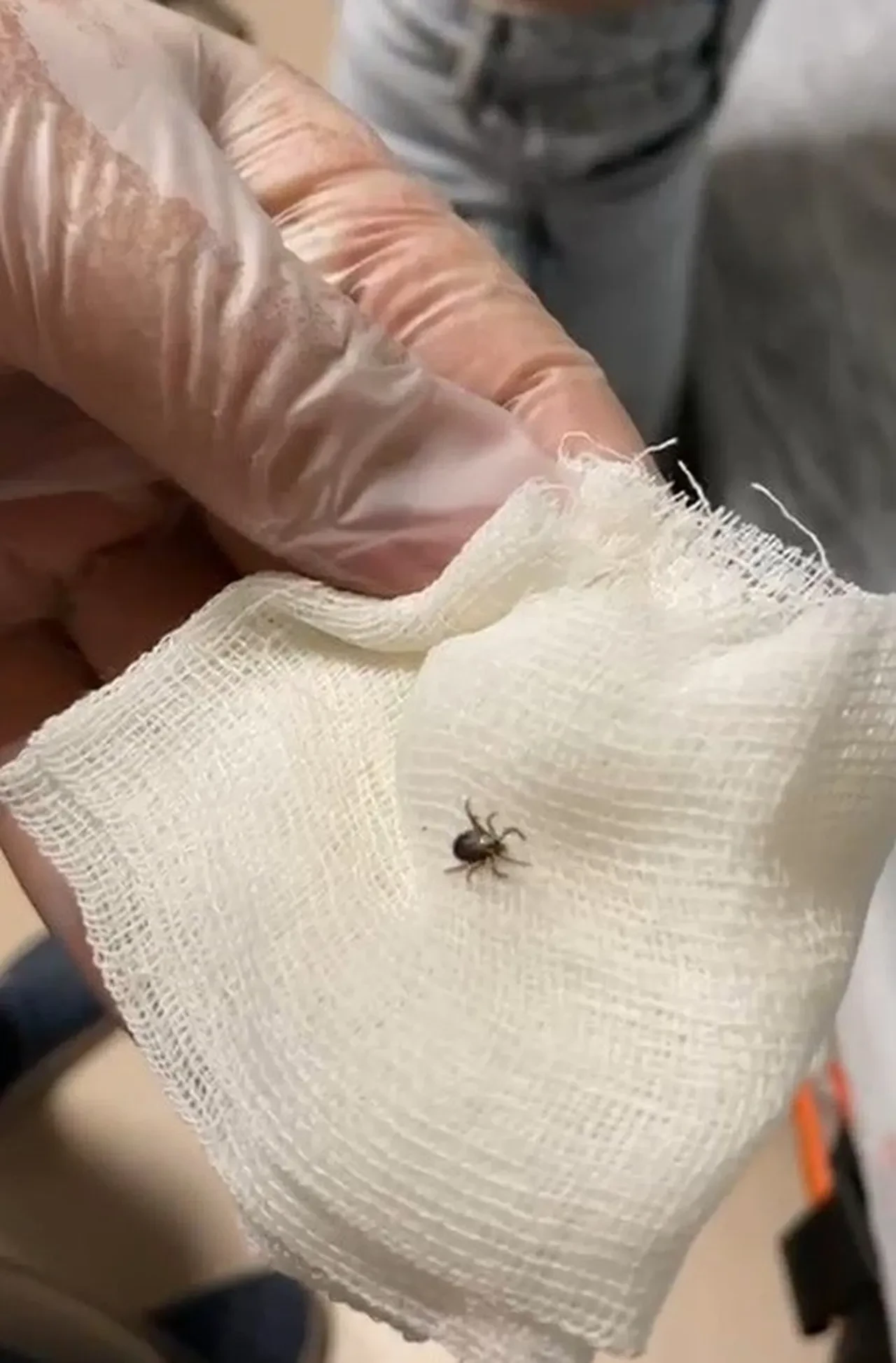 Eskişehir'de kene paniği! Sırtına kene yapışan kadın hastanelik oldu