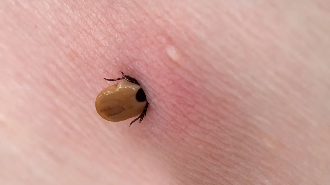 Keneler uçar mı? Piknik alanlarında görünmeyen tehlike