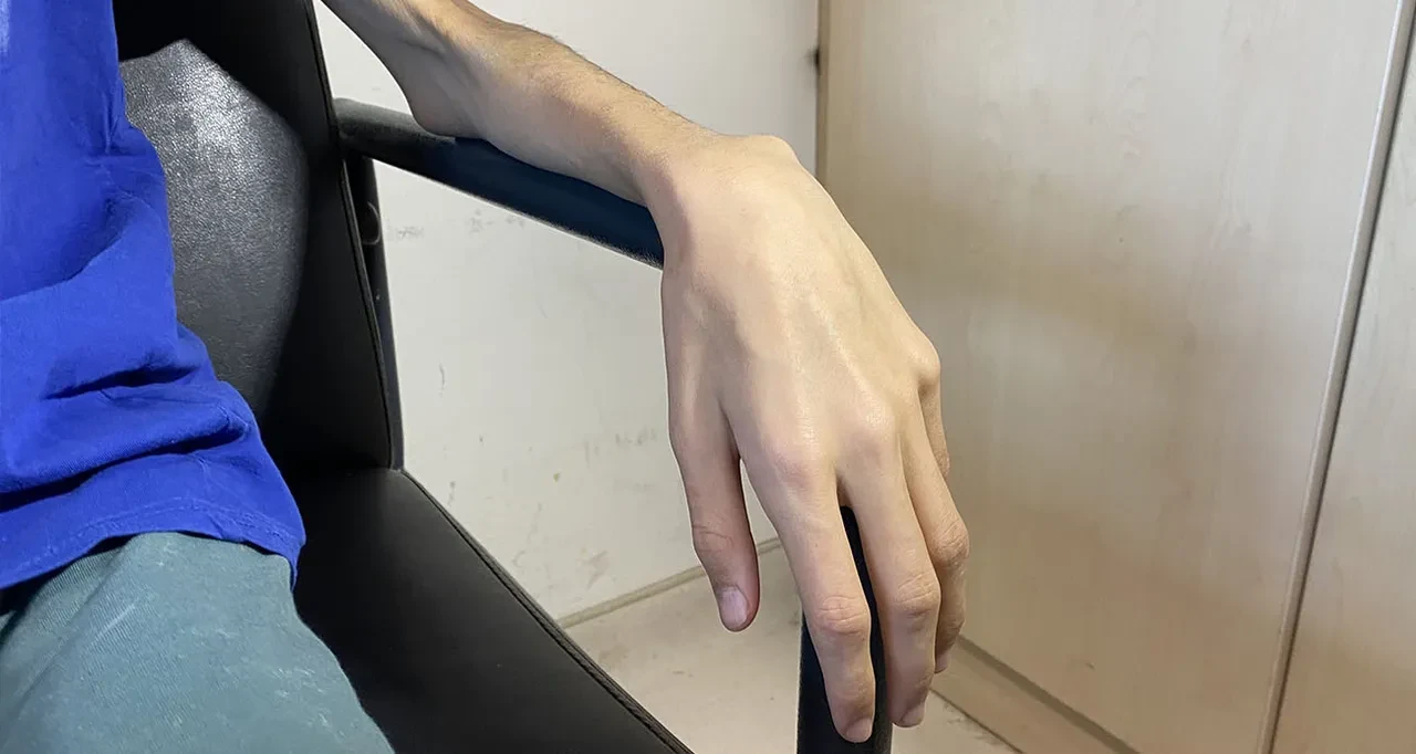 Anoreksiya nedir neden olur? Zayıflamak isterken canınıza kastetmeyin