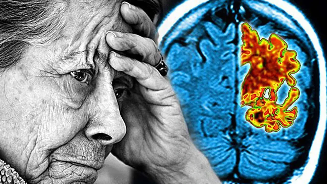 Bunu yapan yaşlanınca unutmuyor! Alzheimera karşı bilim destekli süper alışkanlık