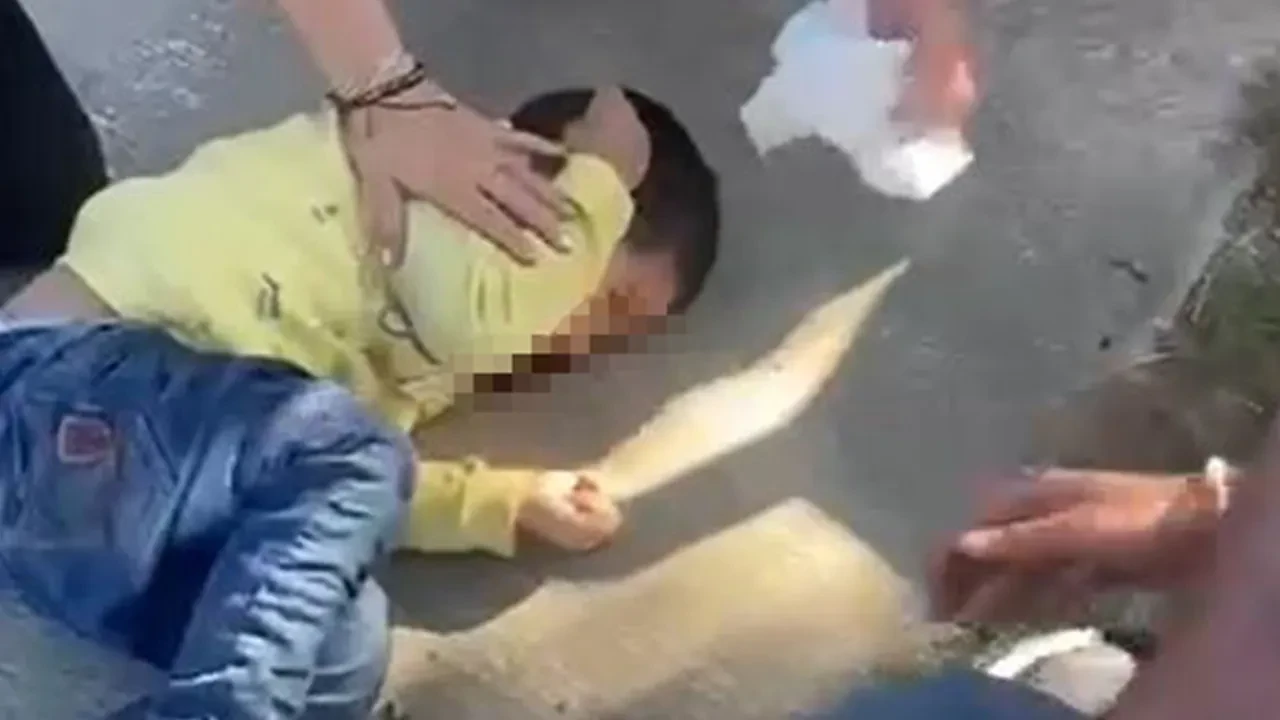 Motosiklet için yasak olan yola girdi, 3,5 yaşındaki çocuğa çarptı