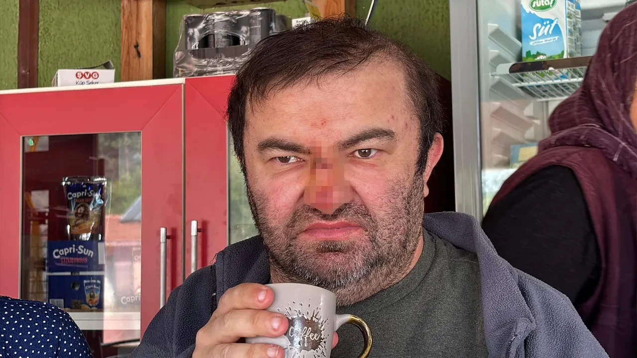 Skandal olay! Yüzde 90 engelli vatandaşı acımasızca dövdüler!
