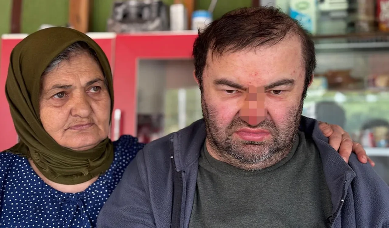 Skandal olay! Yüzde 90 engelli vatandaşı acımasızca dövdüler!