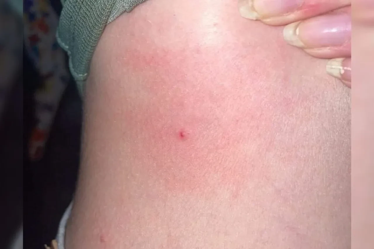 Fransa'da dehşet verici olay! Eğlencede 145 kadına şırıngayla saldırdılar