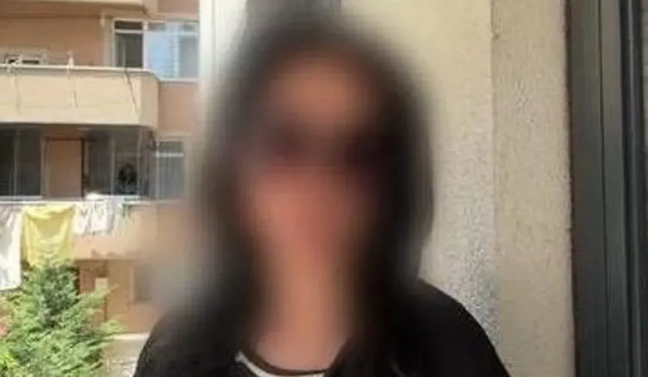 Estetik uğruna hayatı karardı! Doktor cerrah değil diş hekimi çıktı