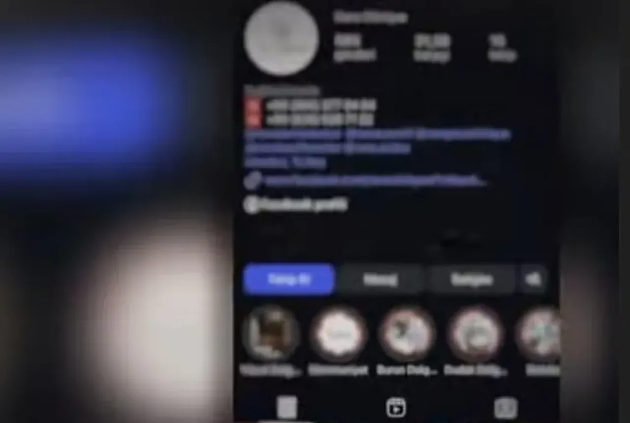 Estetik uğruna hayatı karardı! Doktor cerrah değil diş hekimi çıktı