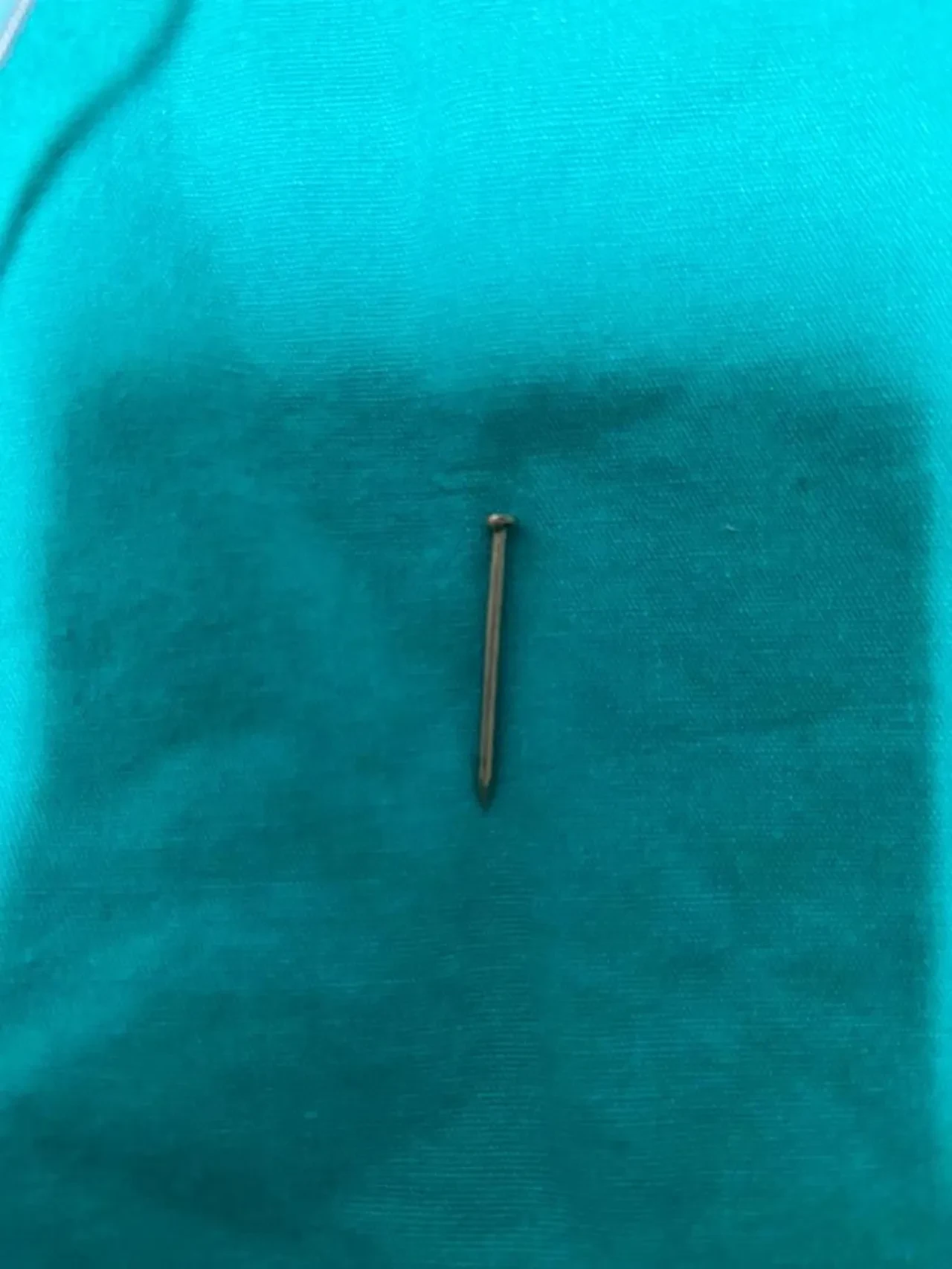 Çocuğun yuttuğu şey ailesine ecel terleri döktürdü! Çıkana herkes şaşırdı