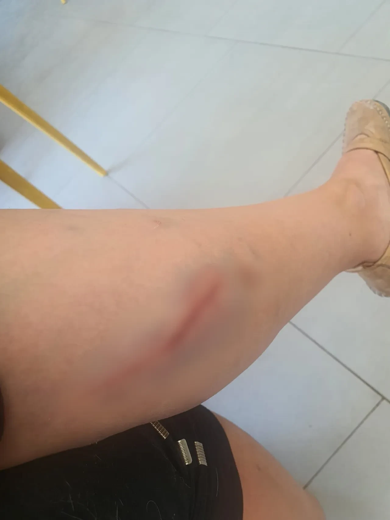 Bursa'da kangal vahşeti! Köpeğini korumak isteyen kadın dehşeti yaşadı