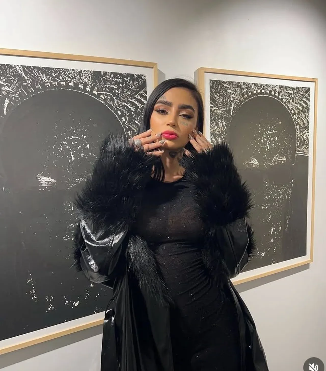 Mozambikli fenomenin İstanbul'da estetik kurbanı olmuştu! Korkunç detaylar ortaya çıktı