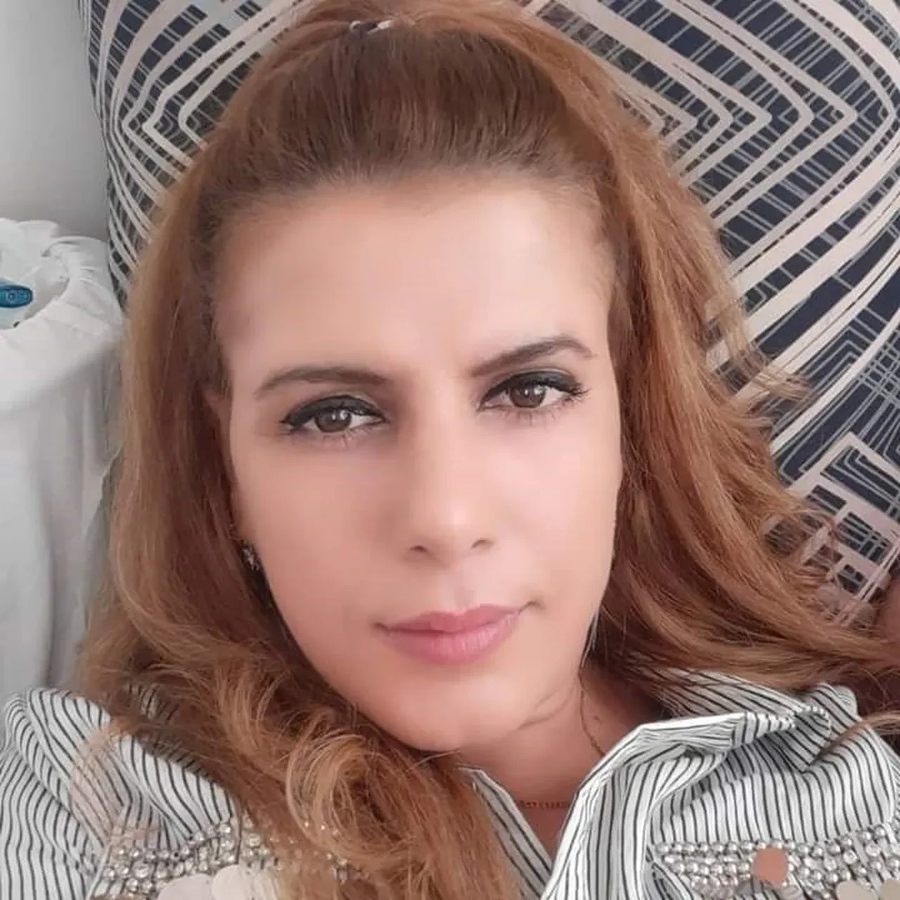 Ayrıldığı sevgilisi hayatını kabusa çevirdi! Uyurken yüzüne ve vücuduna kezzap döktü