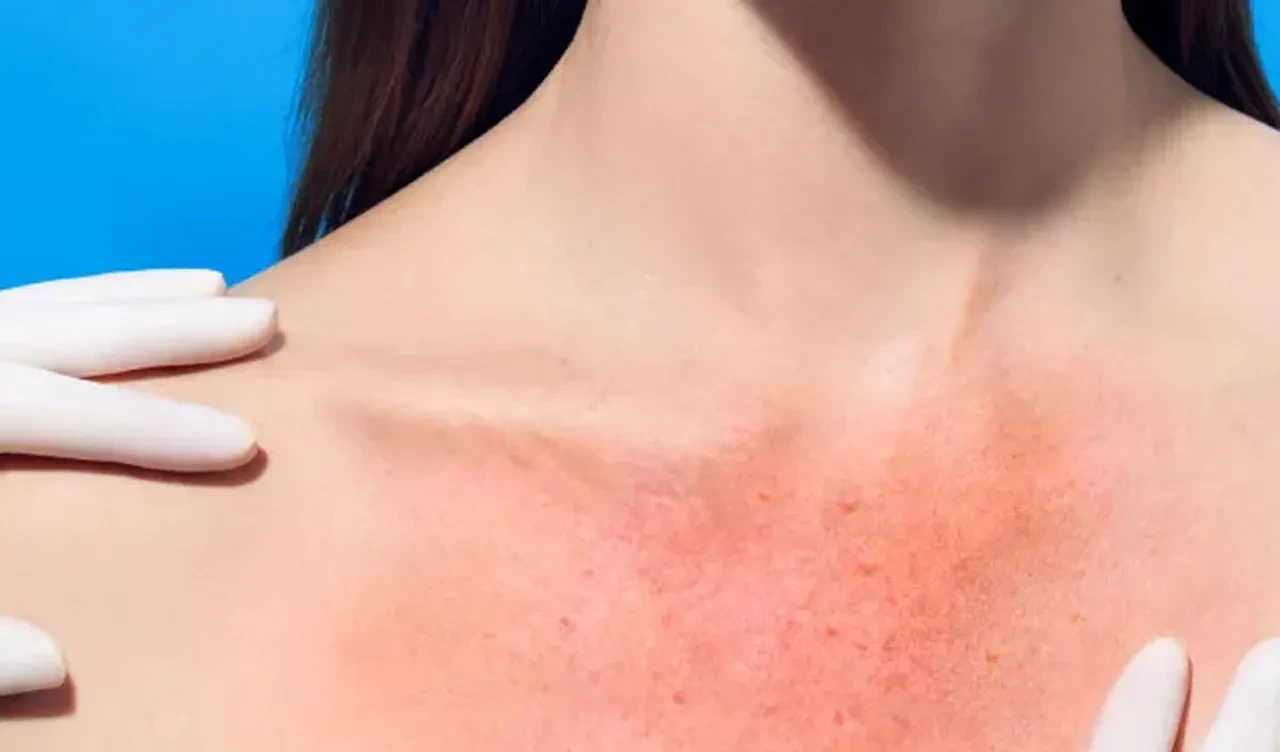 Uzmanlardan kritik uyarı! Vakalar artıyor! Bu saatlere dikkat