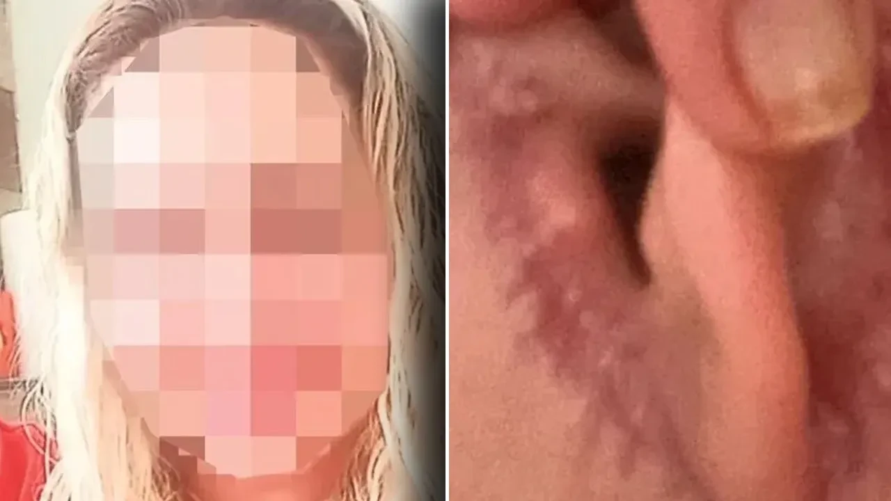 Estetik ameliyatı olan kadın dehşeti yaşadı! Kulağını kesip yüzünü diktiler