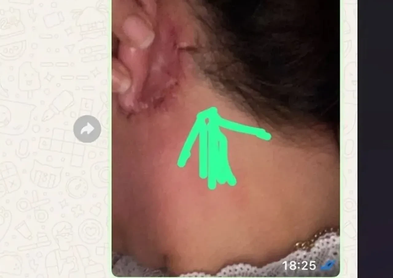 Estetik ameliyatı olan kadın dehşeti yaşadı! Kulağını kesip yüzünü diktiler