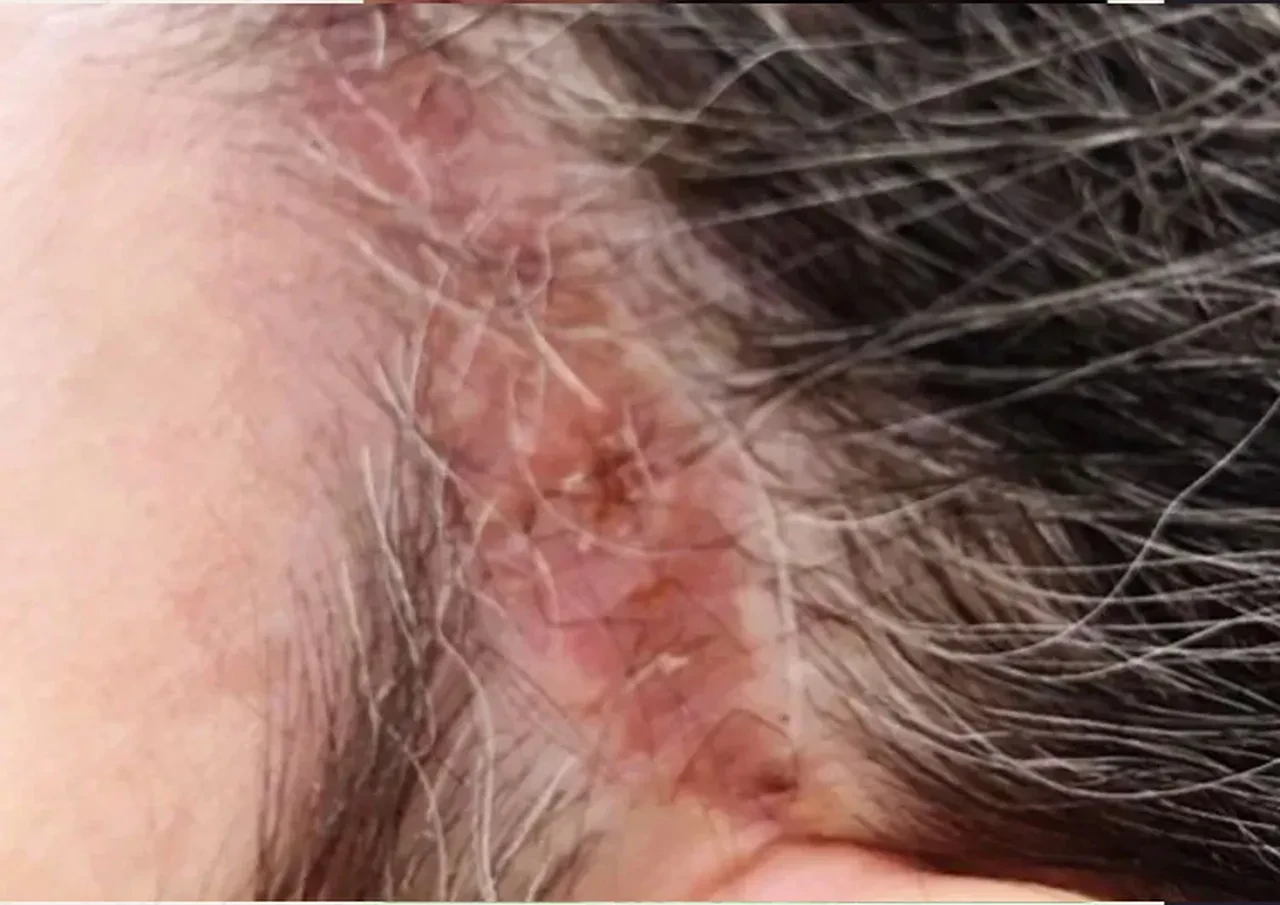 Estetik ameliyatı olan kadın dehşeti yaşadı! Kulağını kesip yüzünü diktiler