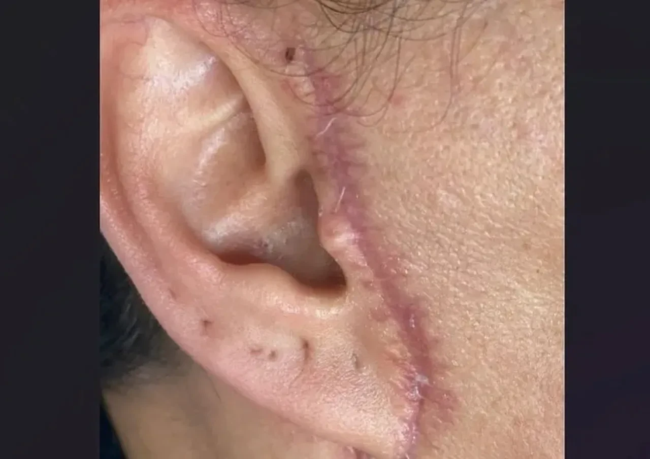 Estetik ameliyatı olan kadın dehşeti yaşadı! Kulağını kesip yüzünü diktiler