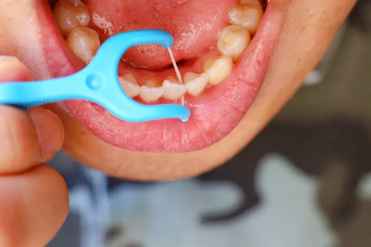 Diş ipinin doğru kullanımı: Diş ipi nedir, ne işe yarar ve nasıl kullanılır?
