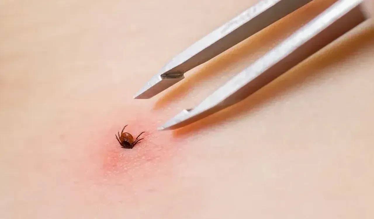 Sivas'ta kene kabusu! Can kaybı artıyor