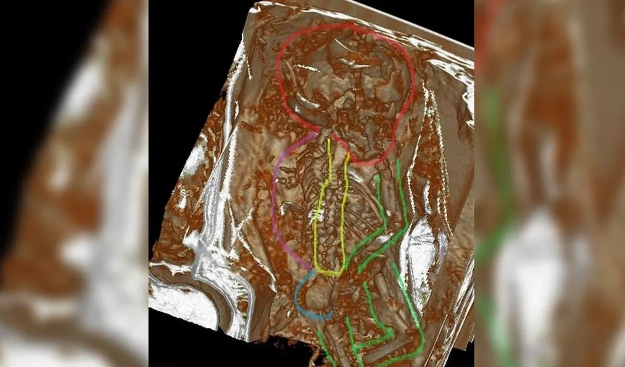 Uzaylı mumyası röntgene sokuldu! İçinden çıkanlar dehşete düşürdü