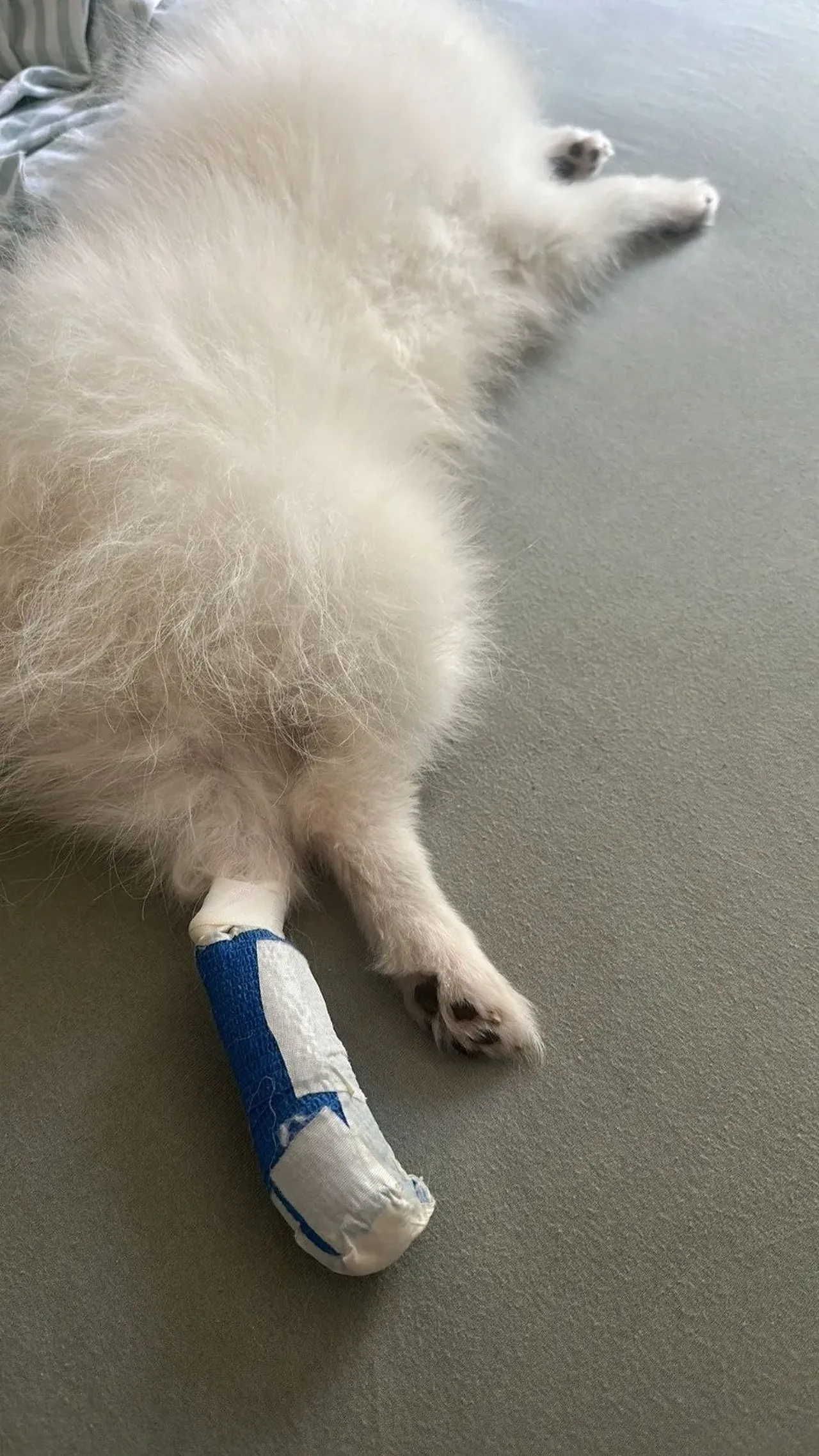 AVM'de yürüyen merdiven dehşeti! Ayağı kırıldı tırnakları koptu