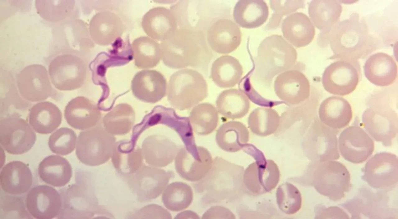 İnsan ve hayvan kanıyla besleniyor, öpücü böceklerle yayılıyor! Ölümcül parazit alarmı