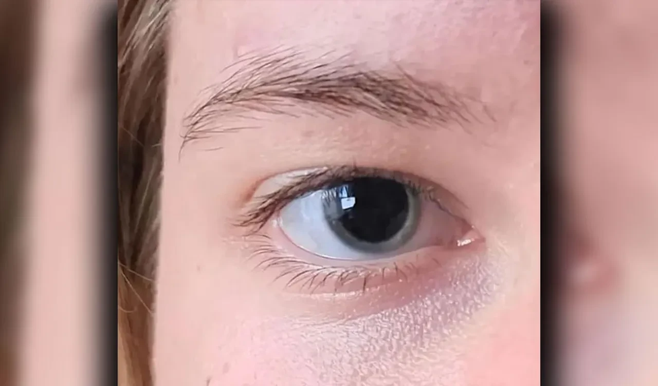 Gözünün fotoğrafını sosyal medyada paylaştı, tanımadığı insanlar hayatını kurtardı