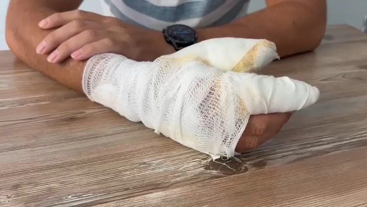 Bingöl'de telefon bataryası patladı! Tamir yapan telefoncu yaralandı