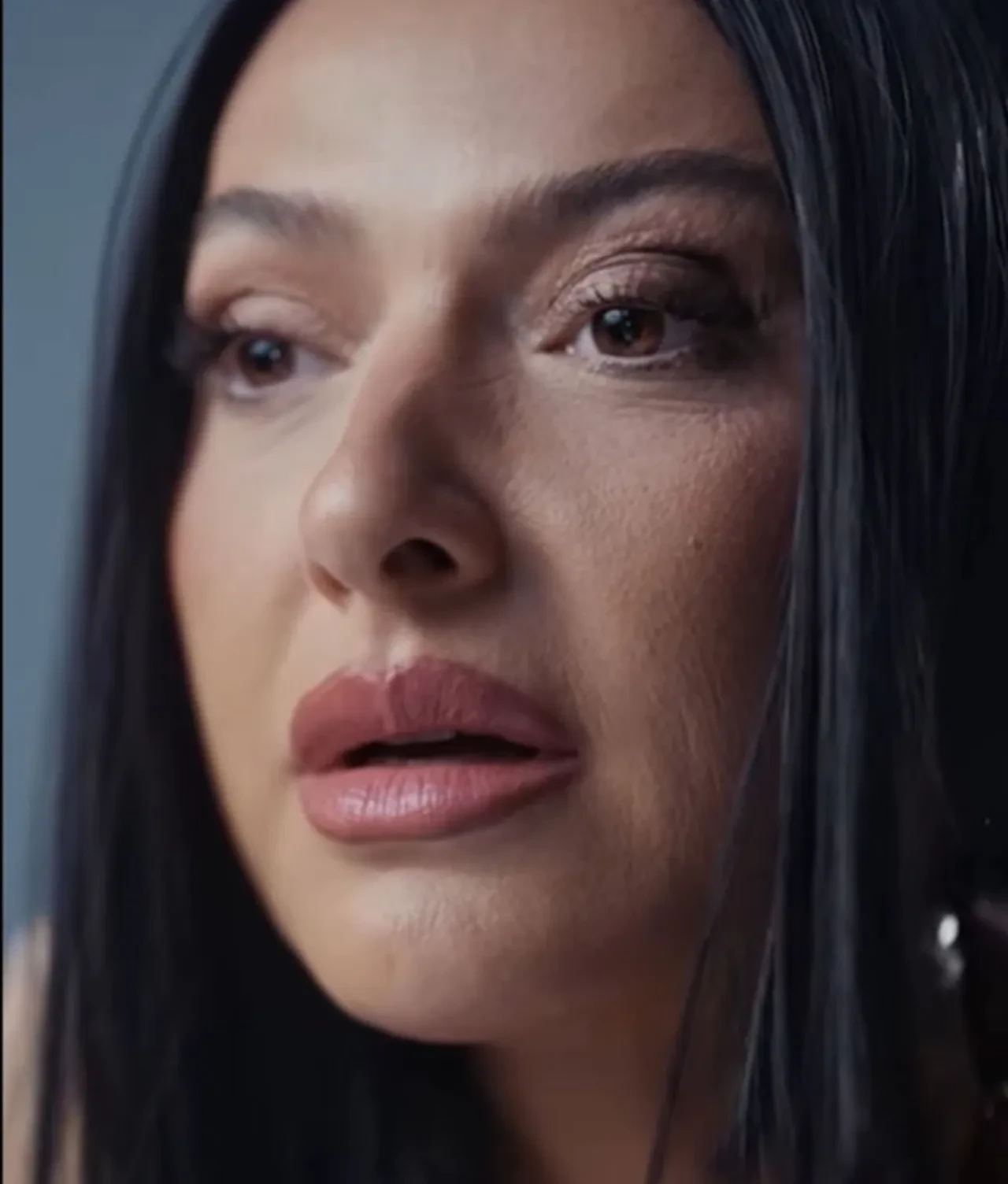 Hadise kırışıklıklarını eleştirenlere ateş püskürdü! İlk destek bakın hangi ünlüden geldi 