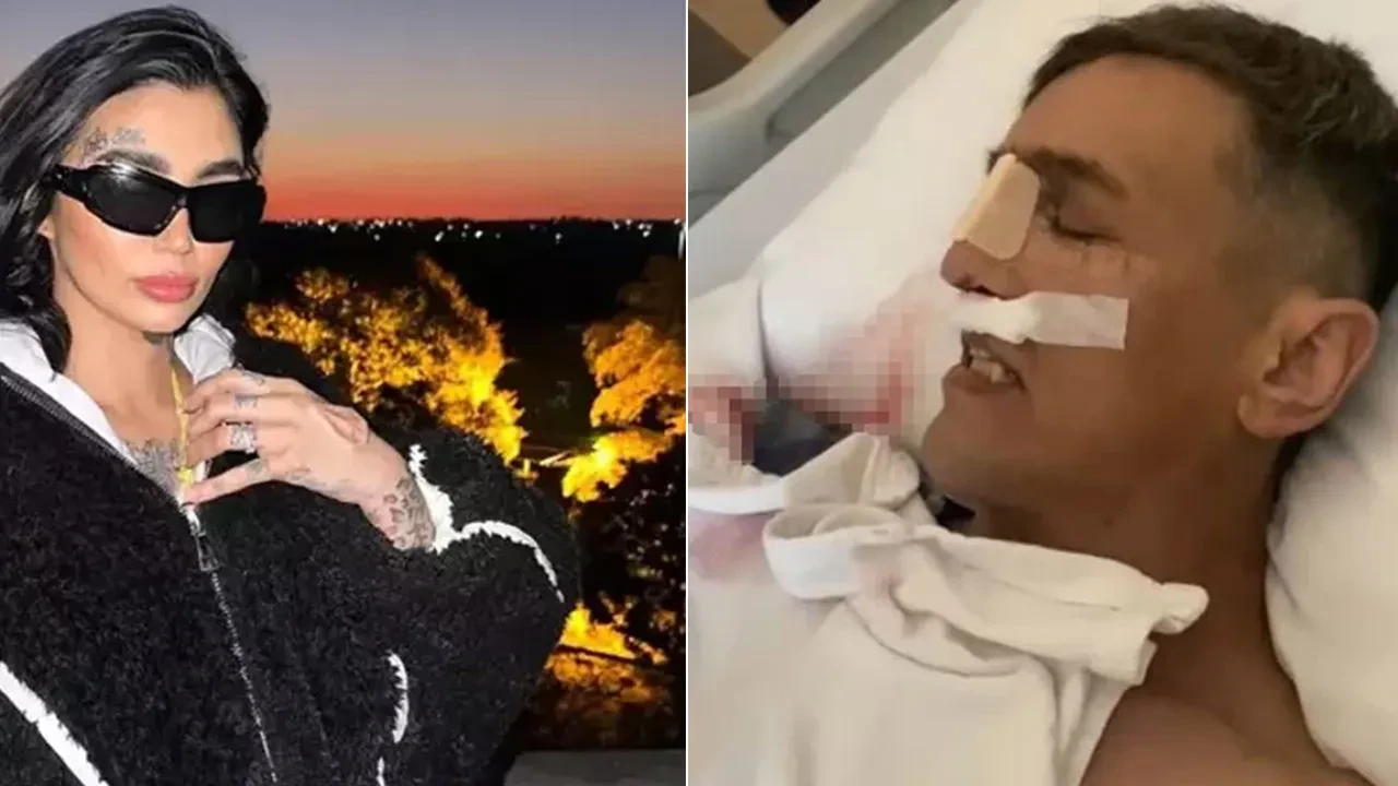 Aynı hastanede burun estetiği ameliyatı sonrası ikinci ölüm! Brezilyalı fenomen de hayatını kaybetmişti