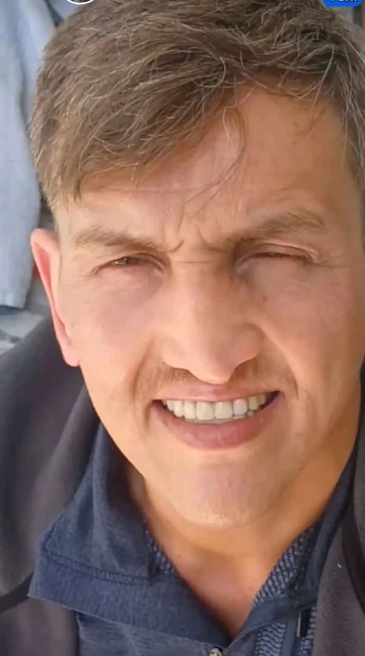 Aynı hastanede burun estetiği ameliyatı sonrası ikinci ölüm! Brezilyalı fenomen de hayatını kaybetmişti