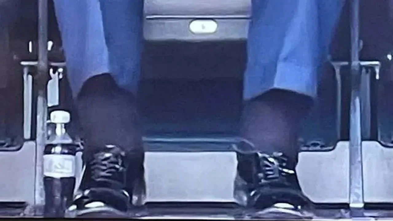 Donald Trump'ın hastalığı açıklandı! Vücudundaki şişlik ve morluklara teşhis konuldu