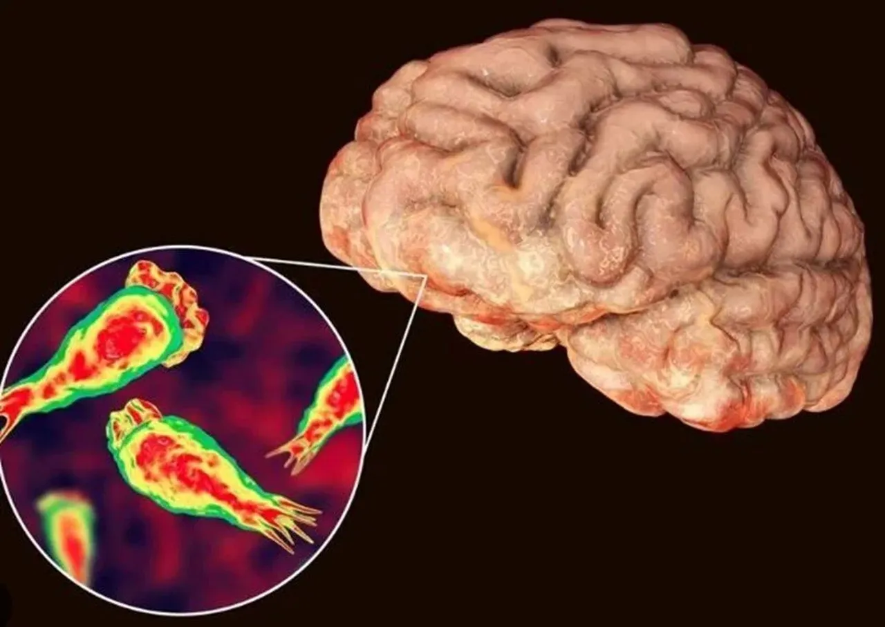 Turizm bölgesini beyin yiyen parazitler sardı! Semptomları aynı grip gibi ama sonu felaket