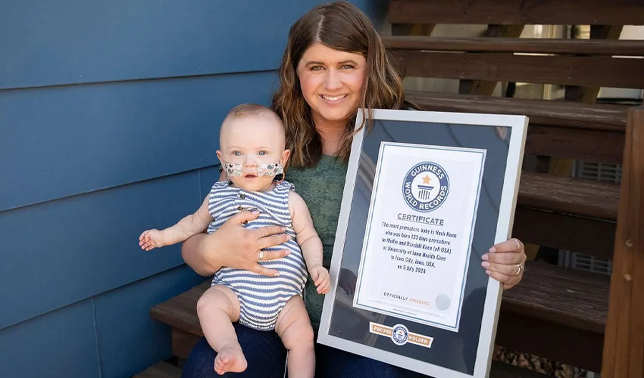 Dünyanın en prematüre bebeği ünvanına sahip! Sadece 280 gram doğdu
