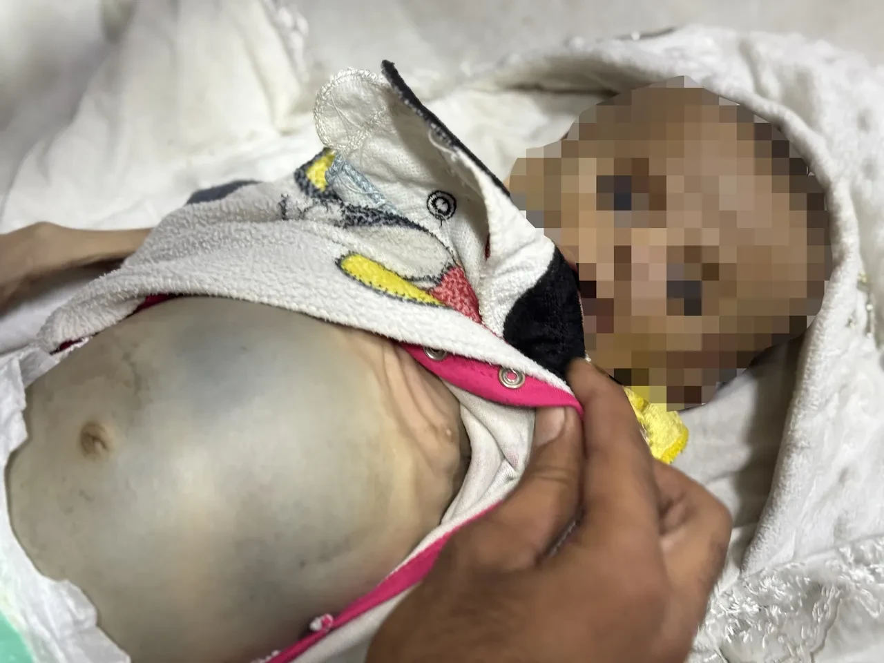 Gazze'de ablukanın acı yüzü: Çocuklar bir bir hayatını kaybediyor