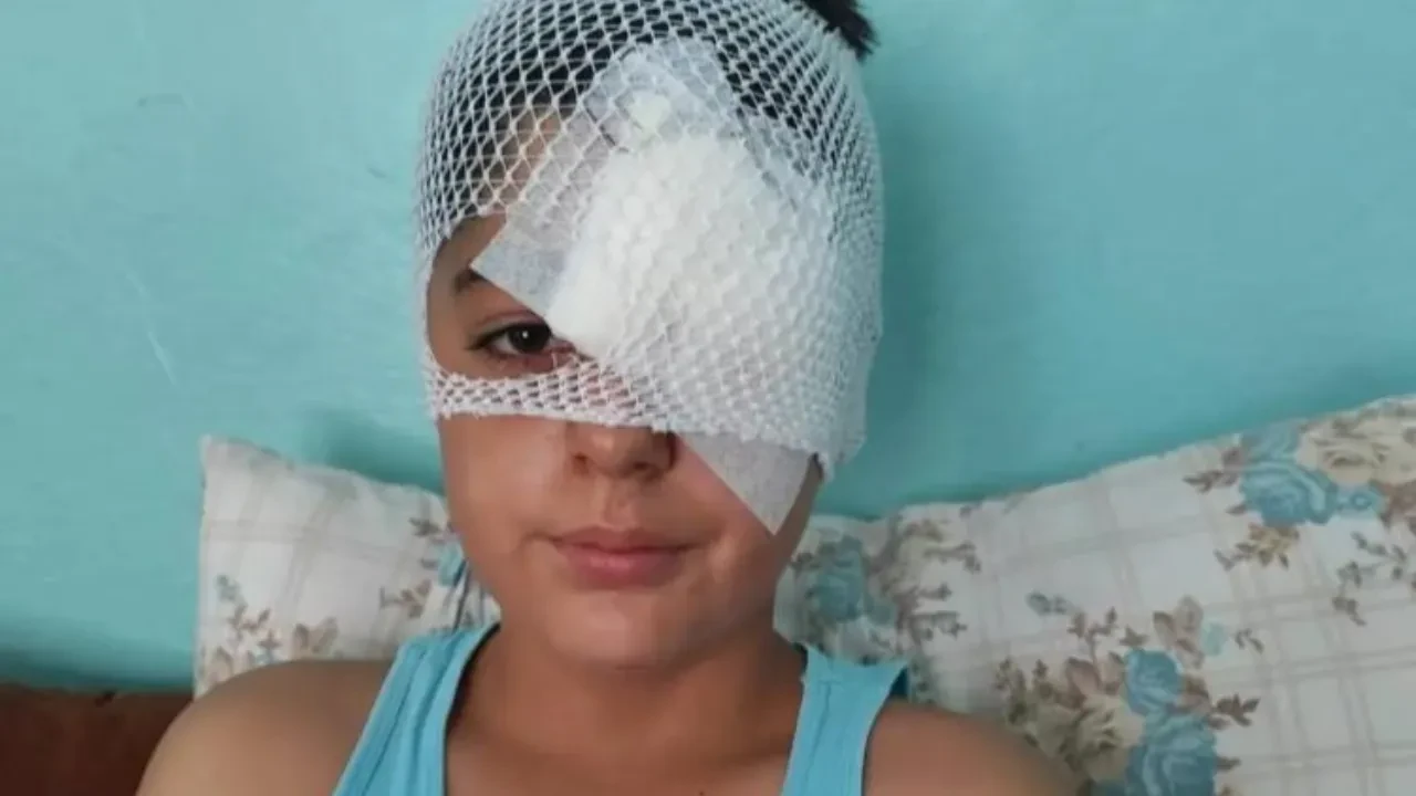 Başıboş köpekler kovalarken otomobil çarptı