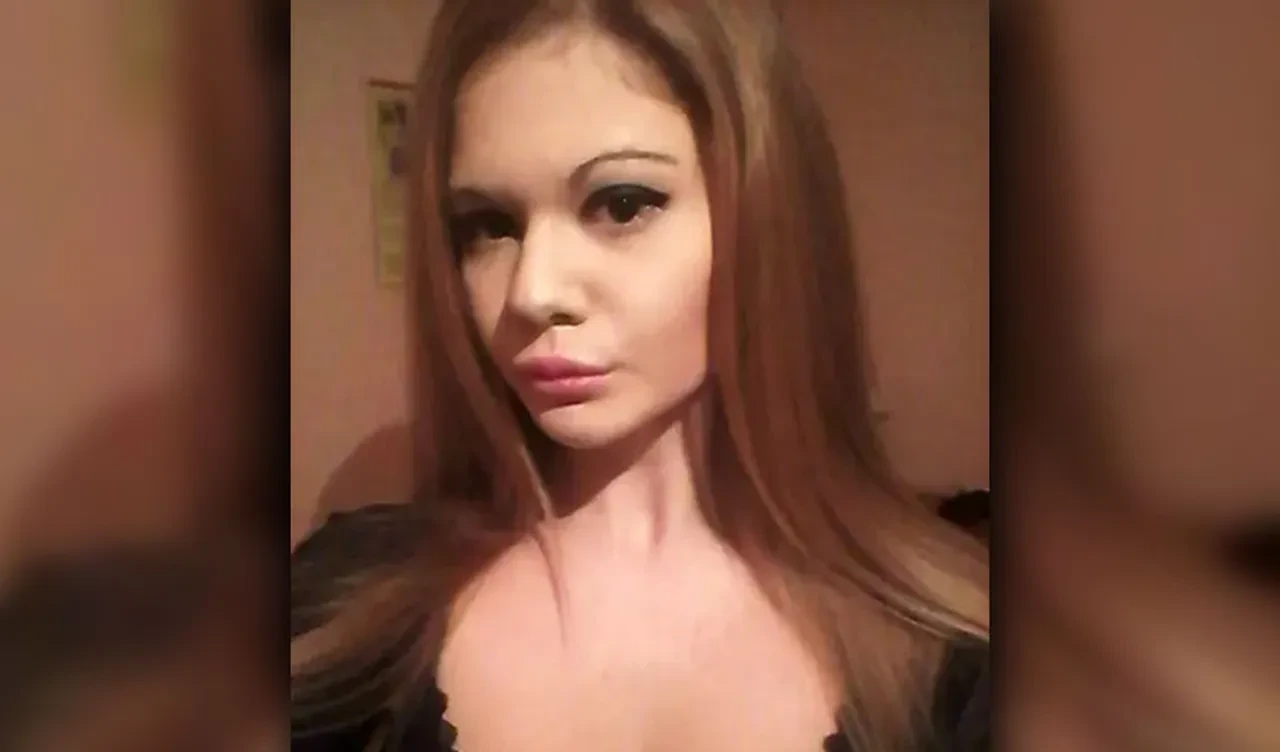 Dünyanın en büyük dudaklı kadınının eski hali görenleri şoke etti