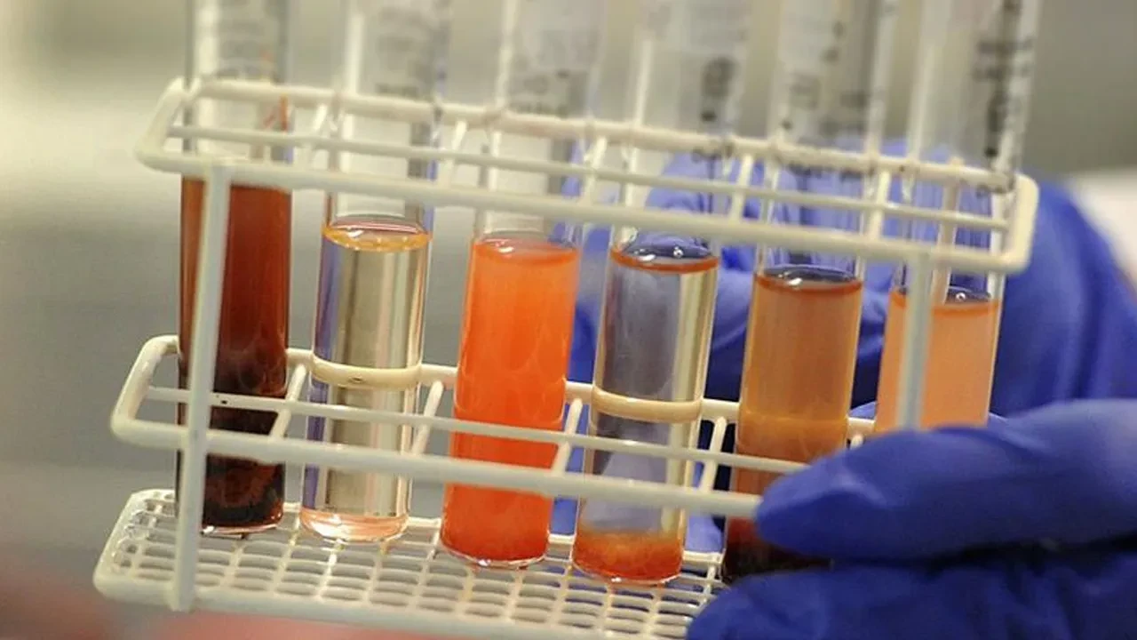 Şizofreni tedavisinin anahtarı lamalarda! Nanokorlar beyni kendine getirecek