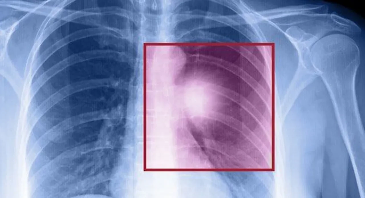 Kedi sahiplerine nefes aldıracak haber! Akciğerine tüy kaçınca öldü denmişti...