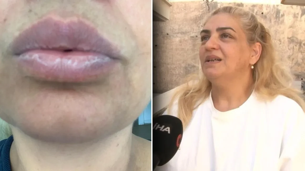 Hiçbir doktor tanı koyamadı! Dilinin yapısı bile değişti: İlaçlar fayda etmiyor 