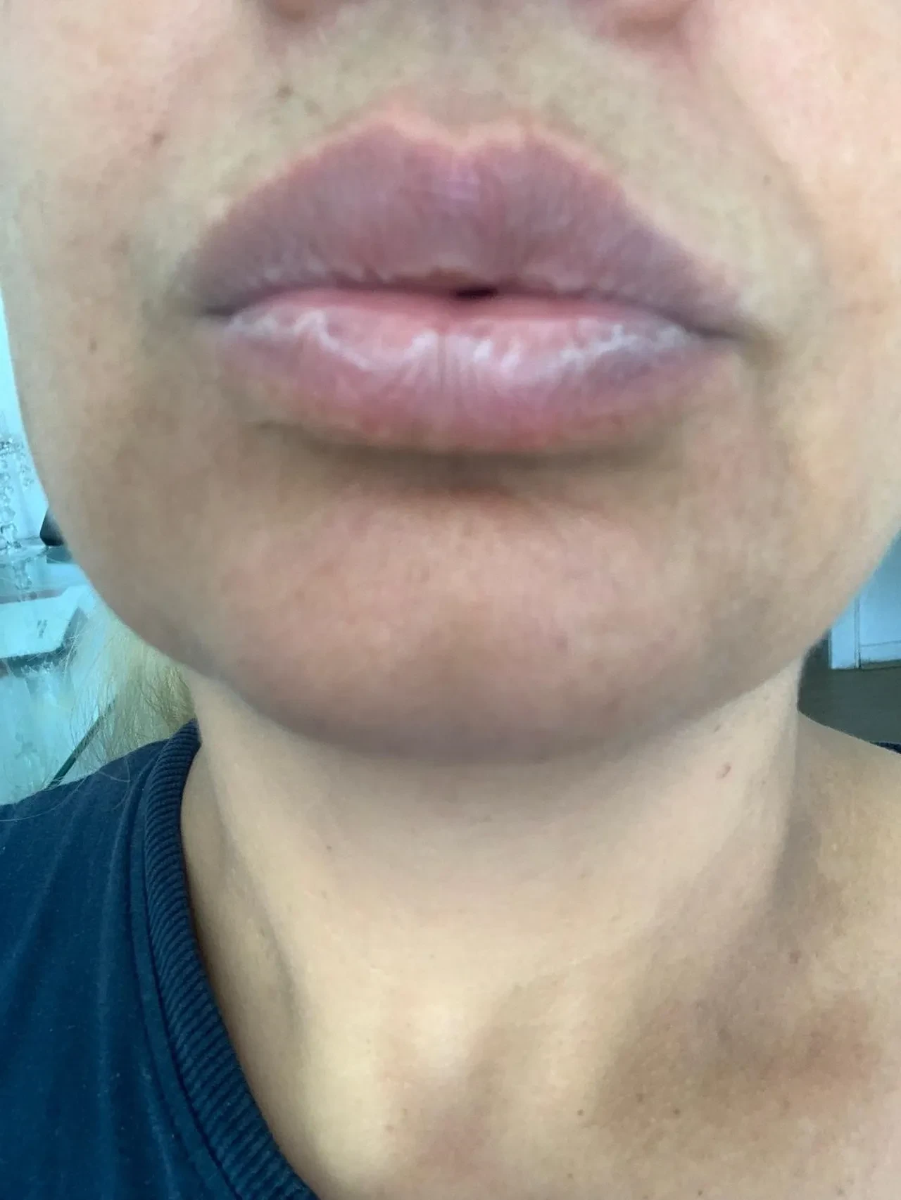 Hiçbir doktor tanı koyamadı! Dilinin yapısı bile değişti: İlaçlar fayda etmiyor