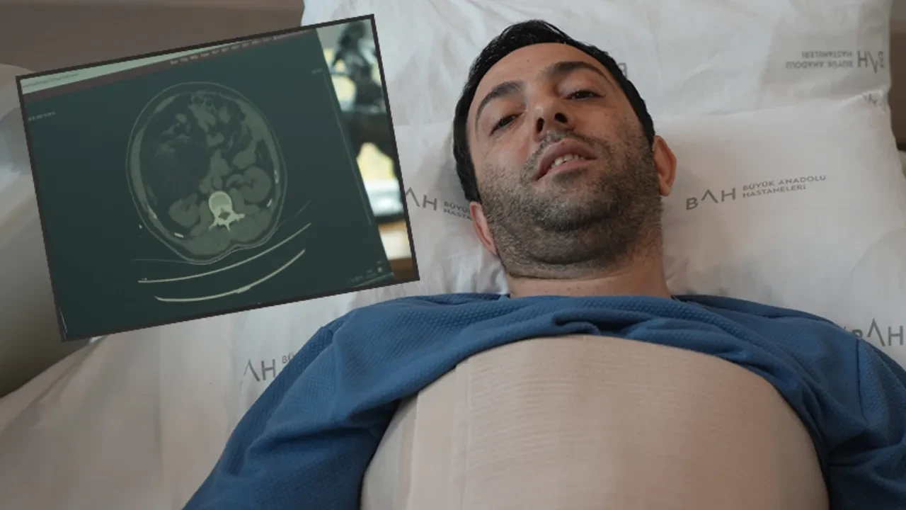 Karın ağrısı şikayetiyle gittiği hastanede büyük şok yaşadı! Doktorlar bile şaşkına döndü