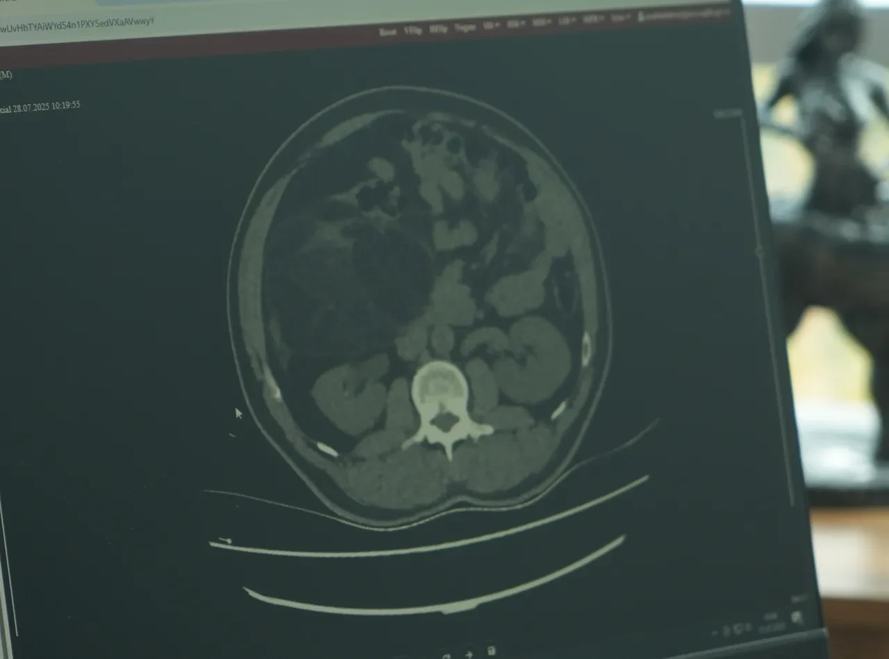 Karın ağrısı şikayetiyle gittiği hastanede büyük şok yaşadı! Doktorlar bile şaşkına döndü