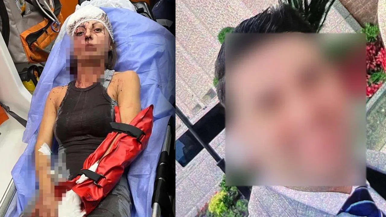 Sokak ortasında vahşet! Eşine yapmadığı kalmadı: Her detayı korkunç