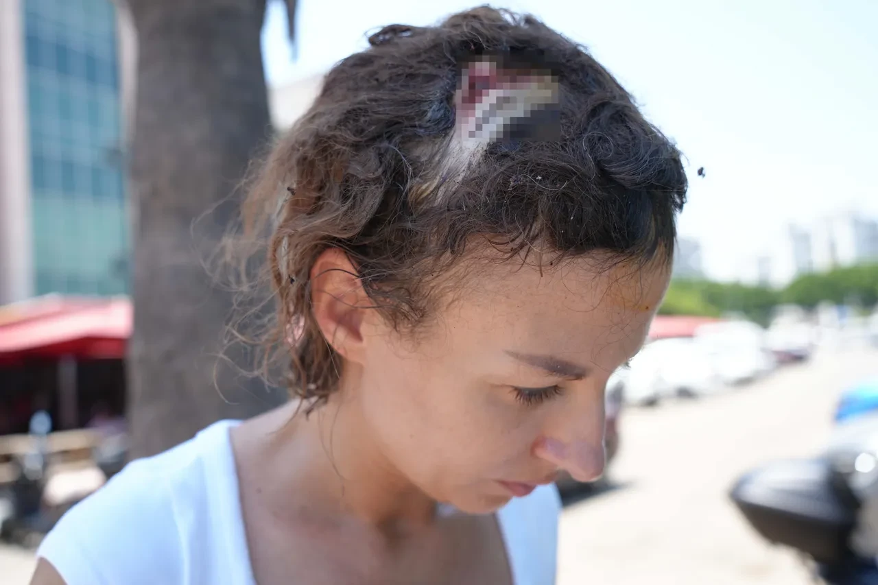 Sokak ortasında vahşet! Eşine yapmadığı kalmadı: Her detayı korkunç