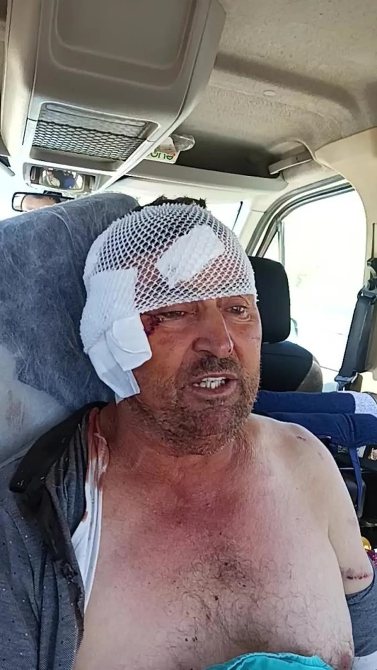 Aslan saldırısına uğramıştı! Son sağlık durumu açıklandı: 'Tam bir Kara Murat'