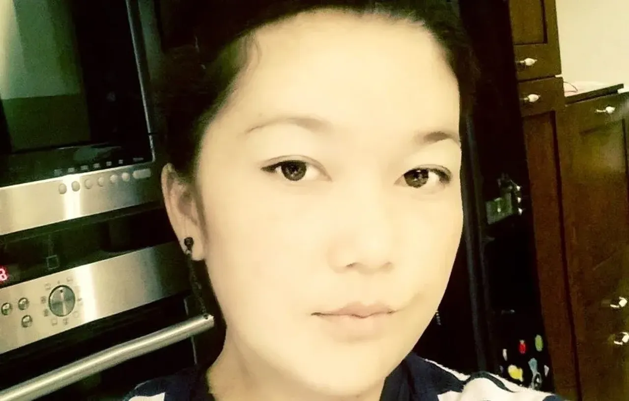 Bir estetik faciası daha! Güzelleşeyim derken canından oldu 