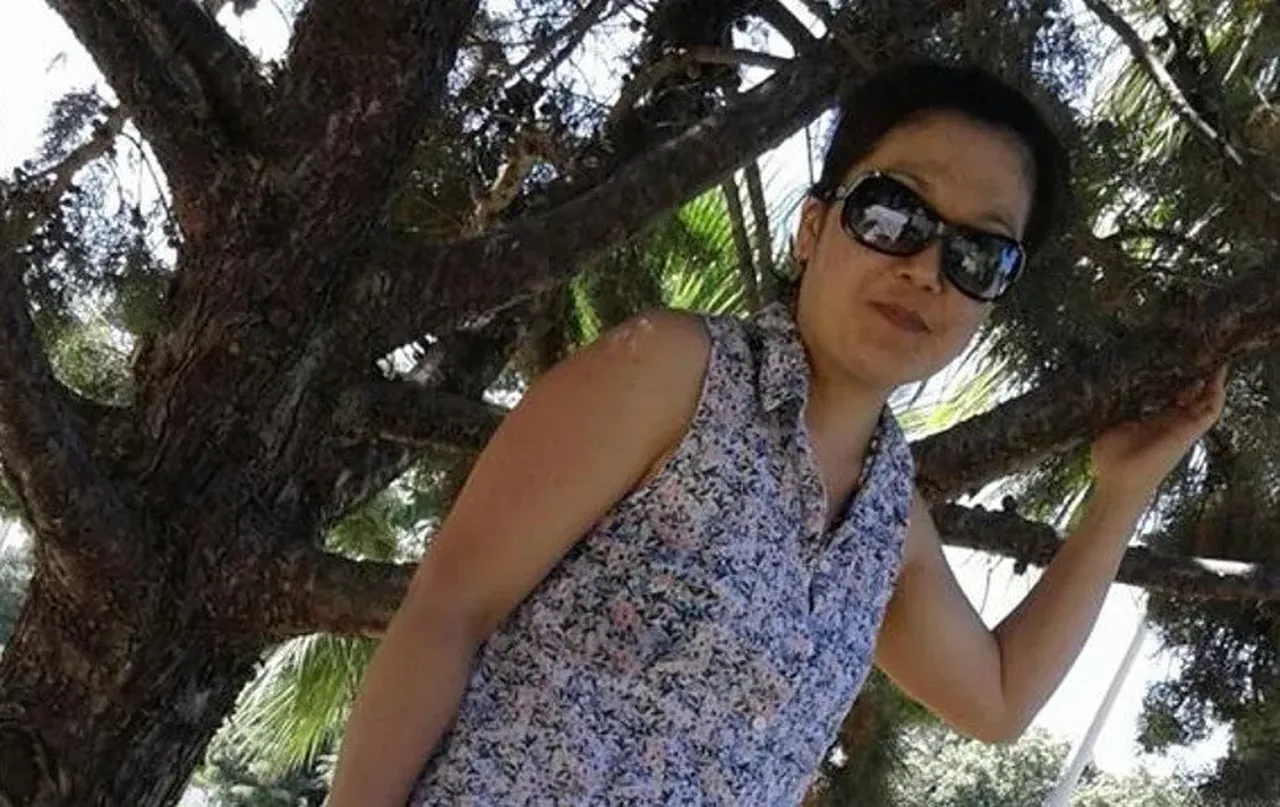 Bir estetik faciası daha! Güzelleşeyim derken canından oldu 