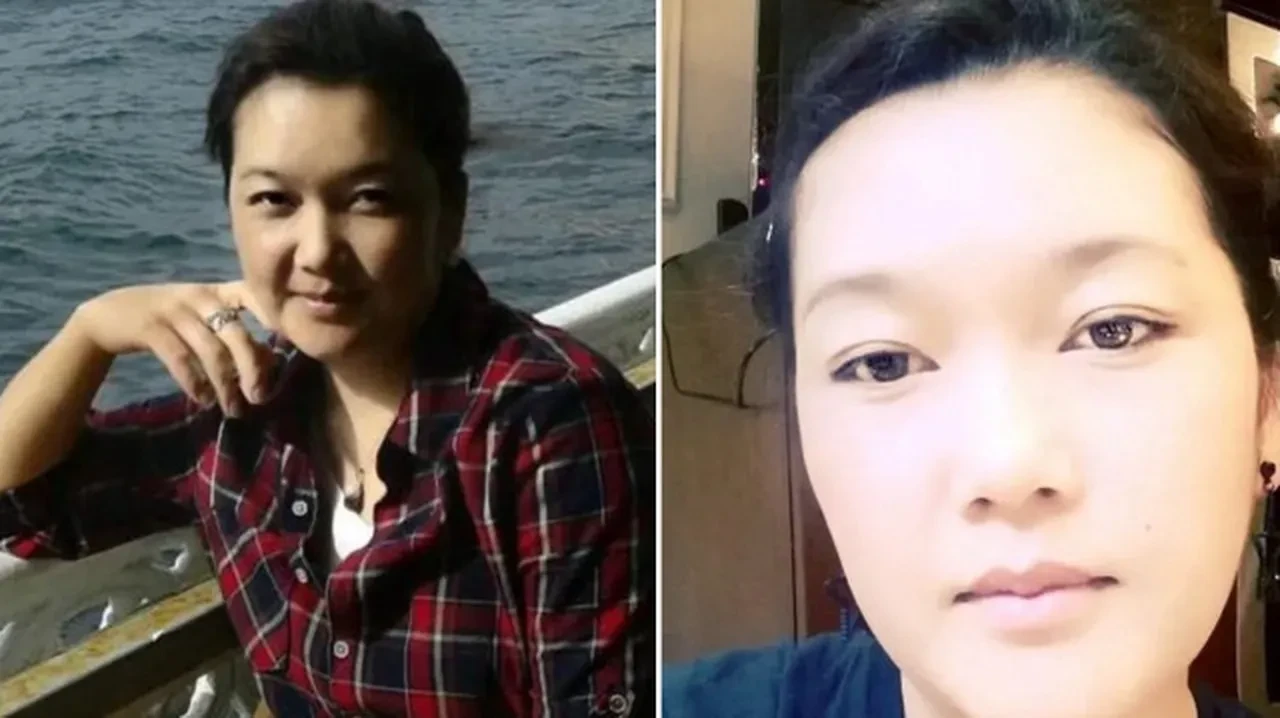 Bir estetik faciası daha! Güzelleşeyim derken canından oldu 