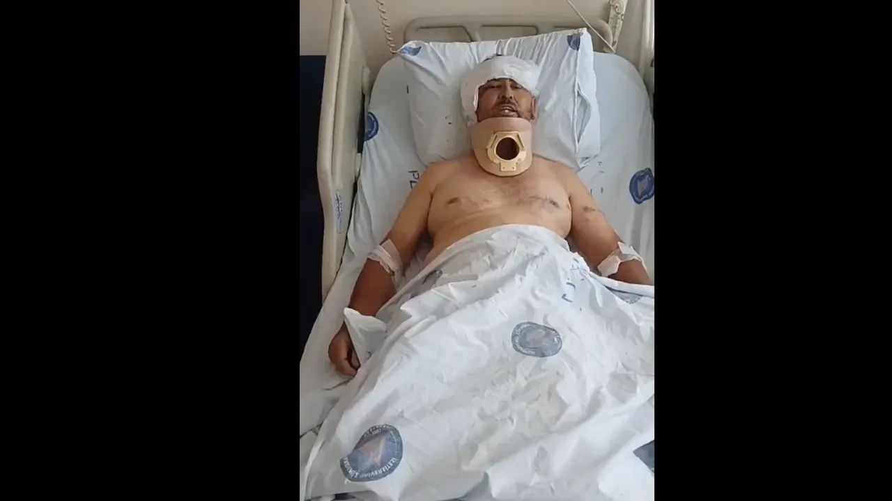 Aslan saldırısına uğrayan adamdan Ali Koç'a çağrı! 'Derbiyi statta izleyeyim'