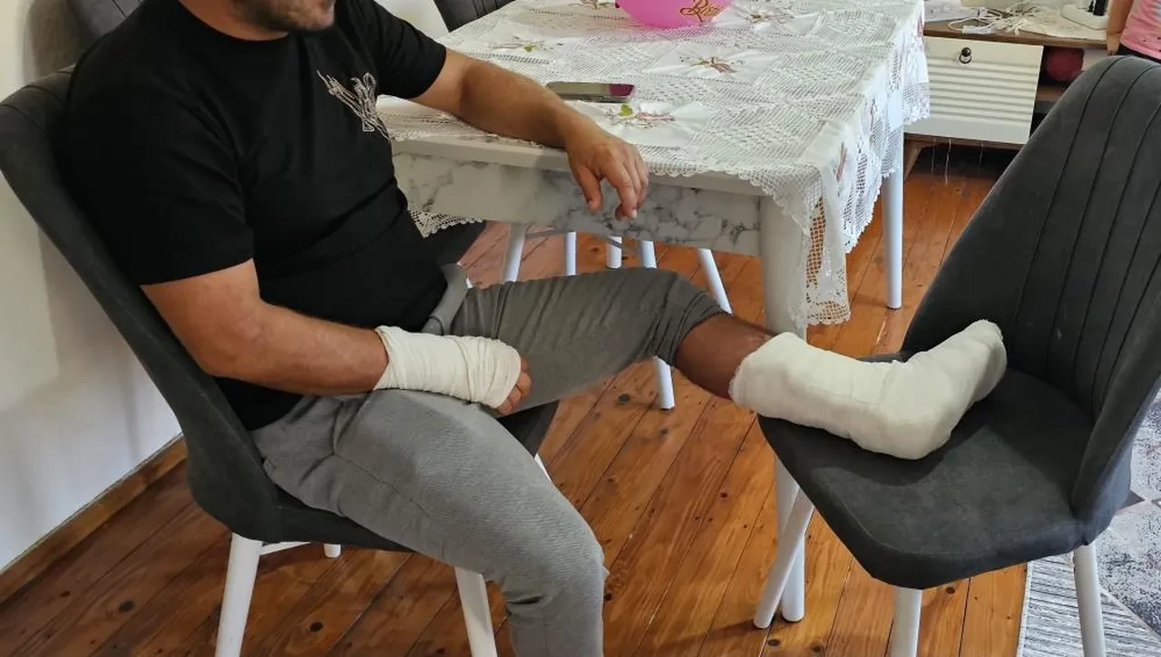 Başıboş köpek dehşeti durmuyor! Bacağı 2 yerden kırıldı 