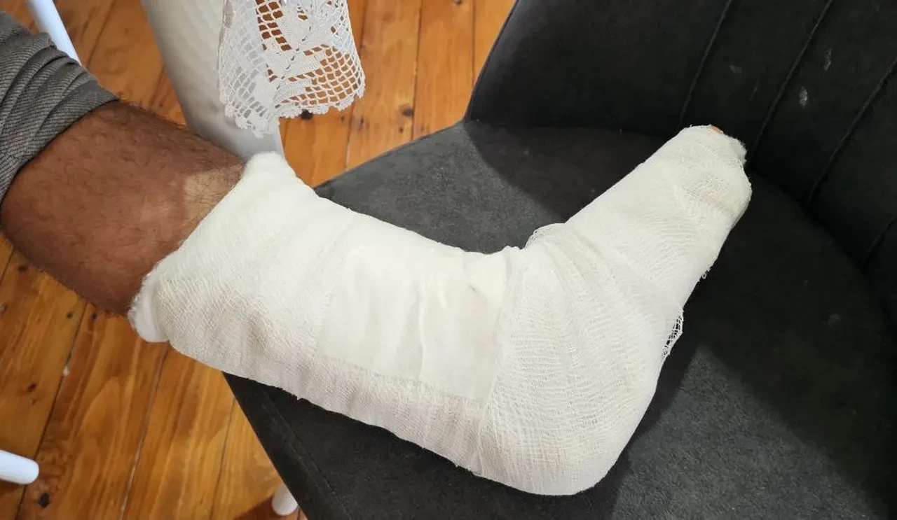 Başıboş köpek dehşeti durmuyor! Bacağı 2 yerden kırıldı 